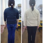 K様4回目施術前